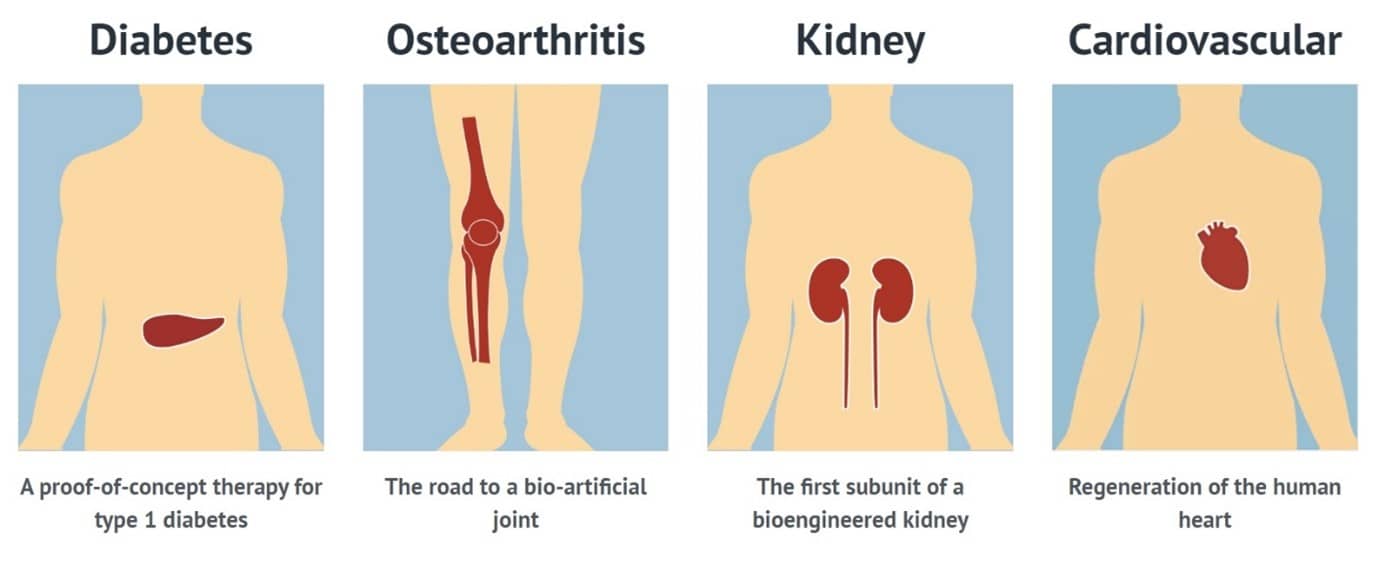 RegMed XB is currently focused on developing therapies for diabetes type1, renal failure, osteoarthritis and cardiovascular disease. (Material: RegMed XB)