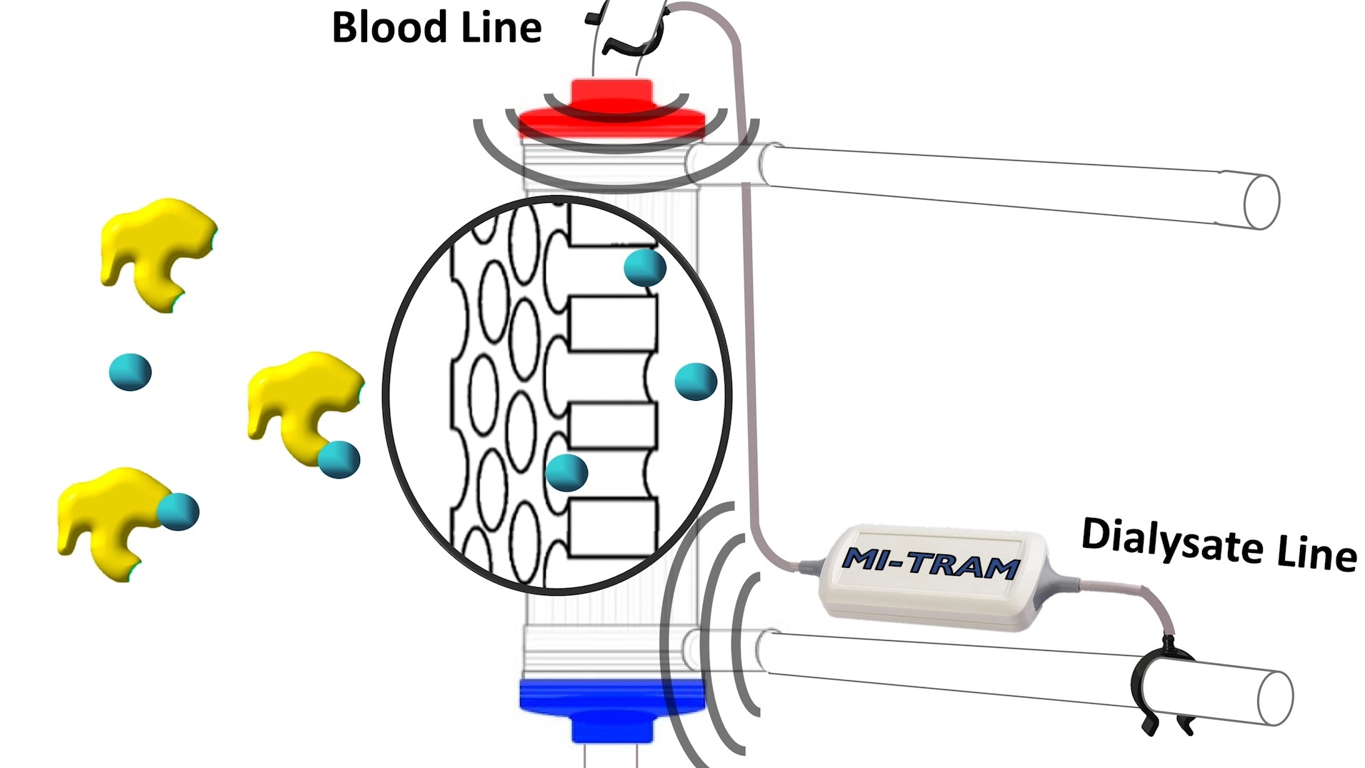 Kidney5